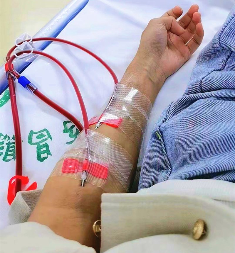 器官移植:生命的桥梁